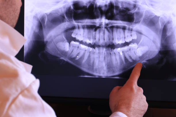 Best Emergency Treatment for Toothache in Iuka, MS