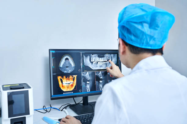Best Emergency Wisdom Teeth Removal in Iuka, MS